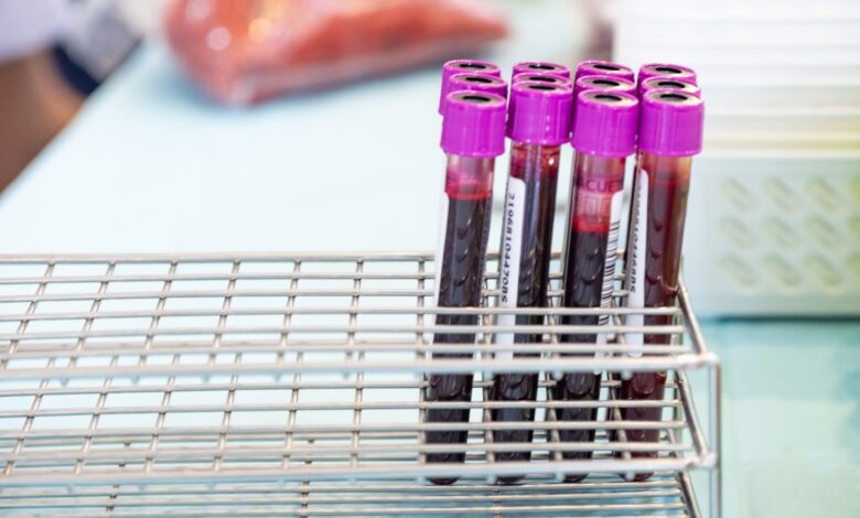 Um tipo sanguíneo parece apresentar risco maior de diabetes tipo 2