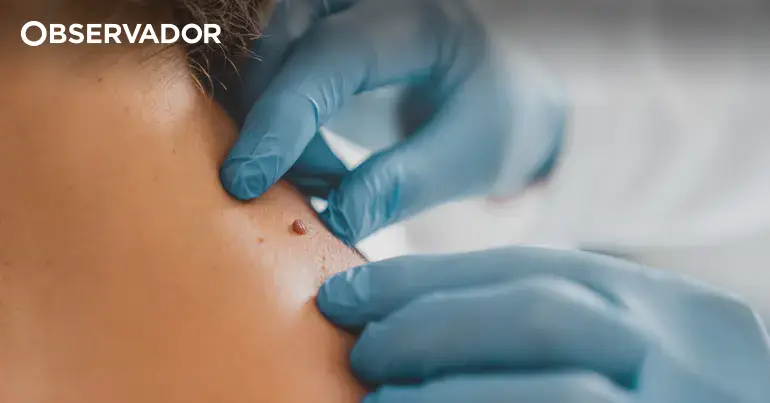 Bactéria da Antártida pode ajudar a curar o melanoma