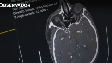 Hospital de Ponta Delgada trata AVC com tecnologia de IA