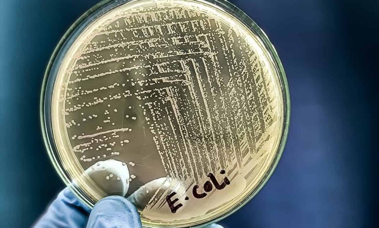 Superbactérias perdem vantagem com novo teste criado por pesquisadores da USP